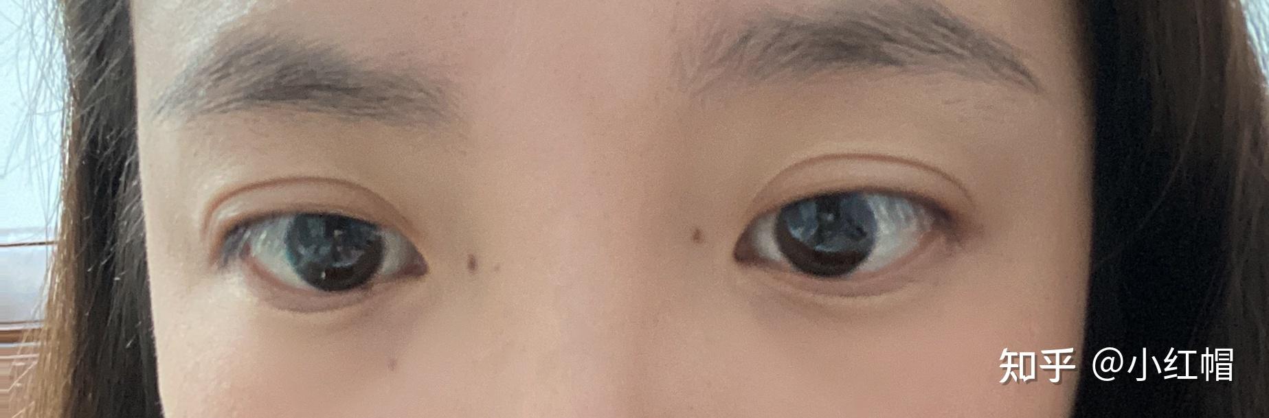 左眼内眼角有痣代表什么吗