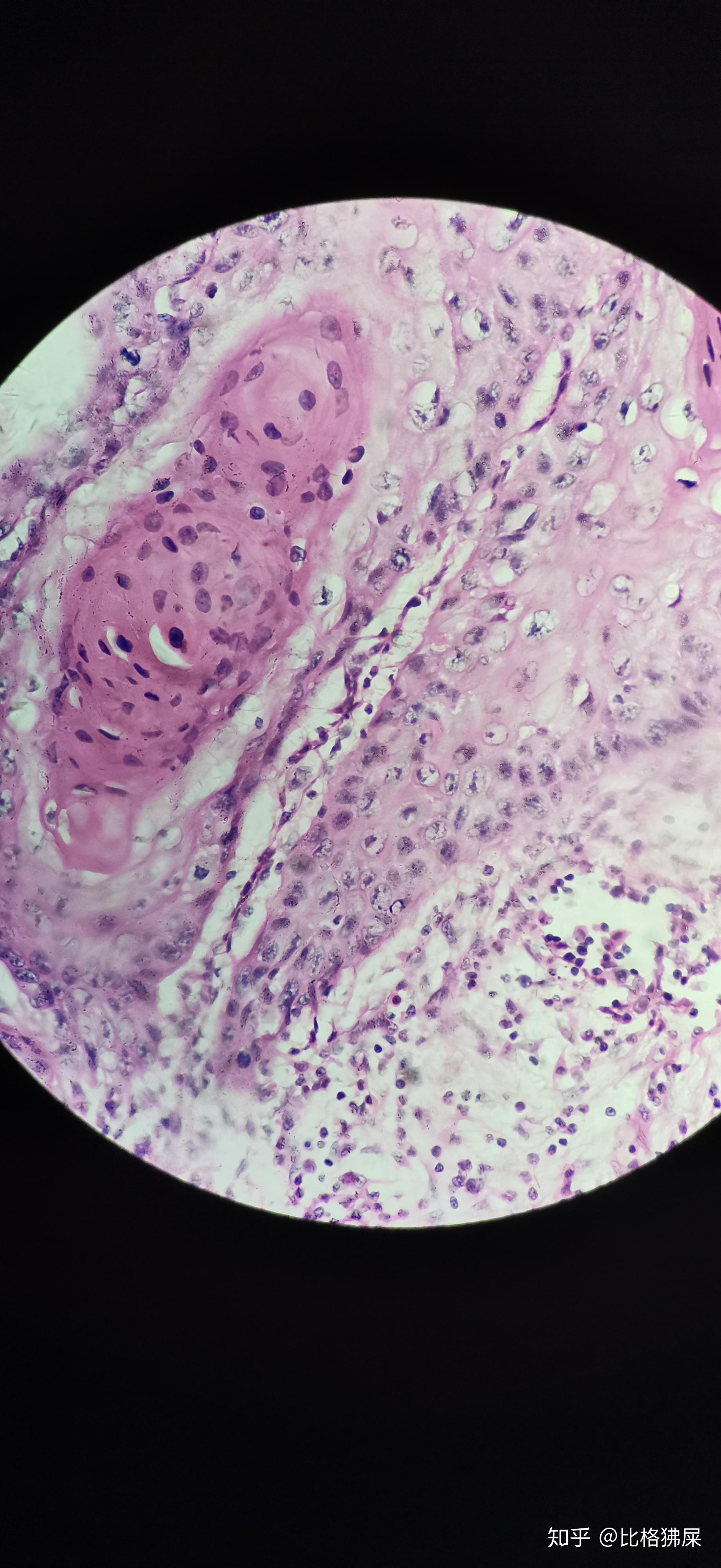 肝血窦显微镜下图片