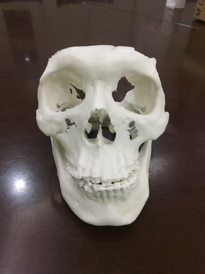 常用一边吃东西导致大小脸改怎么改善?