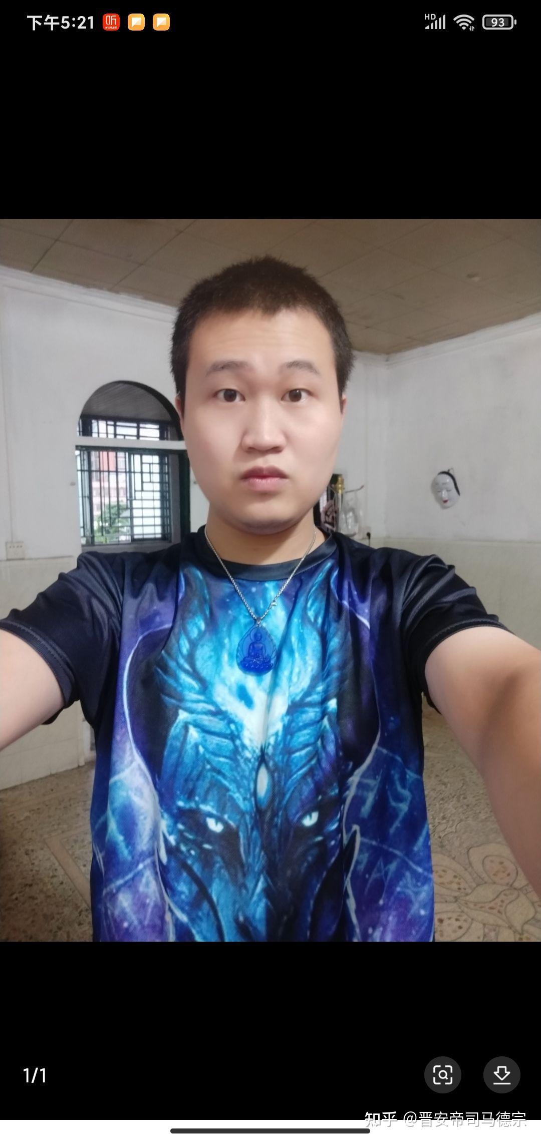 李创发为什么近视