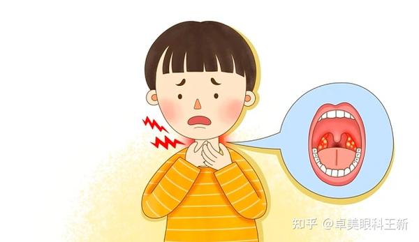 扁桃体发炎,你了解多少? - 知乎