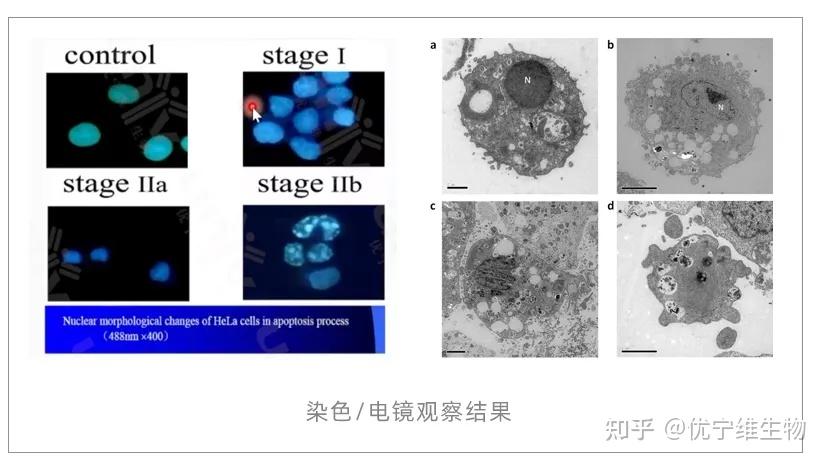 细胞凋亡信号通路全流程研究指南!从模型构建到机制解析,“小优细节君”手把手教会你! - 知乎