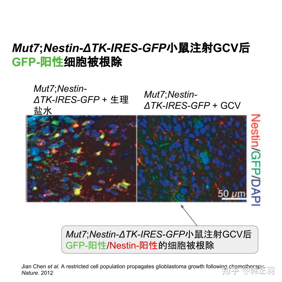 表达nestin-Δtk-ires-gfp的干细胞是神经胶质瘤复发之源