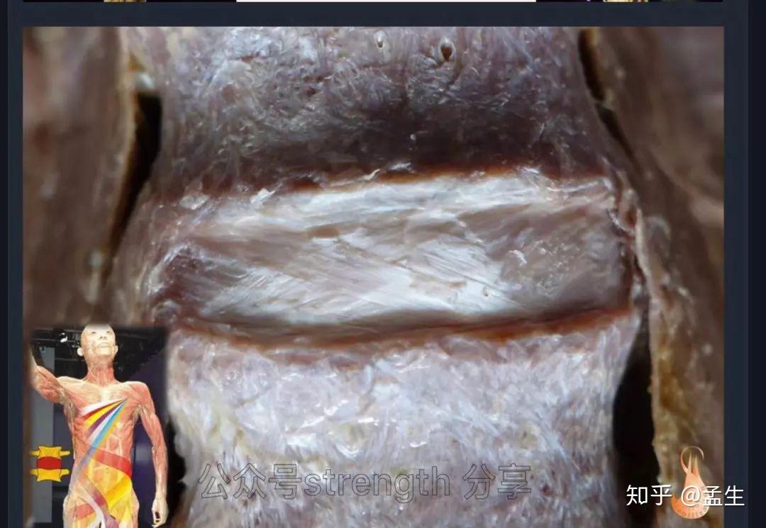 螺旋运动系统——螺旋肌肉链