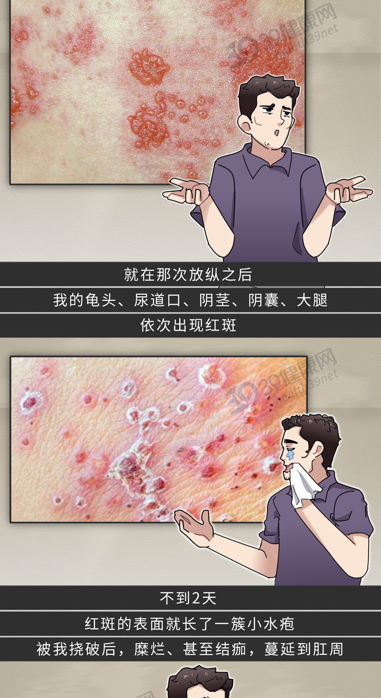 啪啪啪前怎么知道对方没有性病