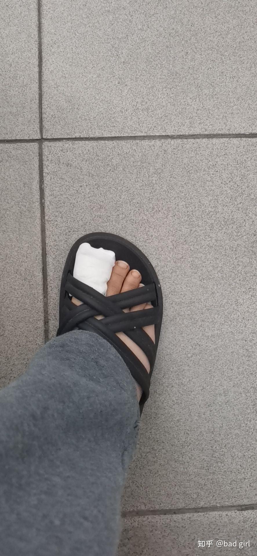 抜甲日记 - 知乎