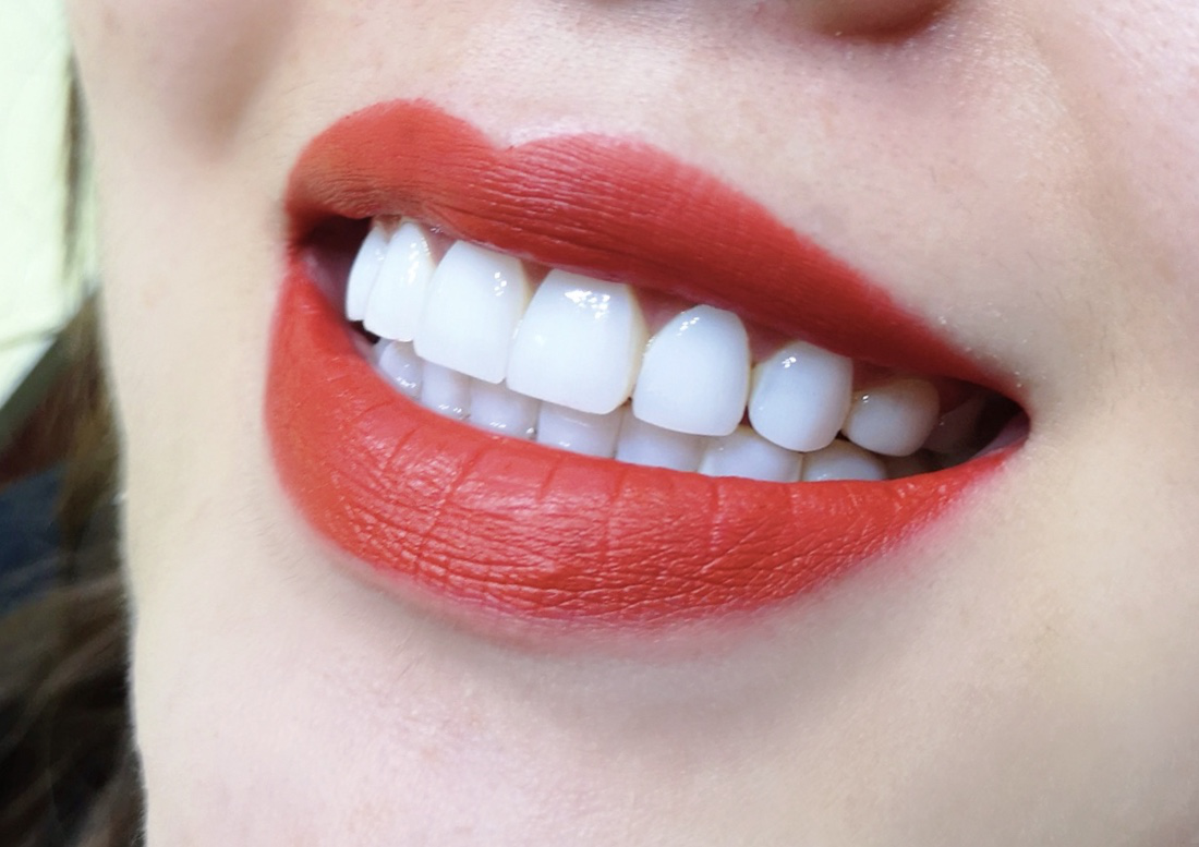 像课本封面一样牙齿表面也要美