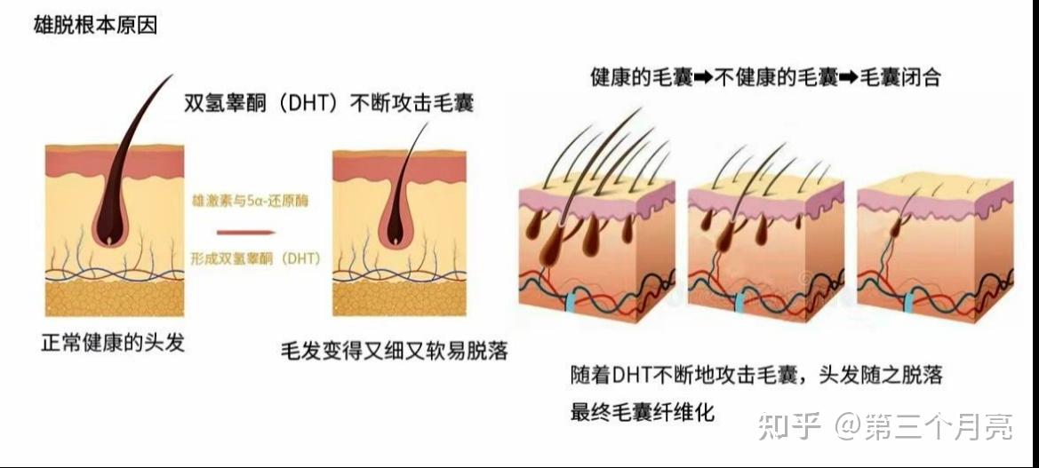 发缝宽的女孩子看过来，能救一个是一个！！ - 知乎