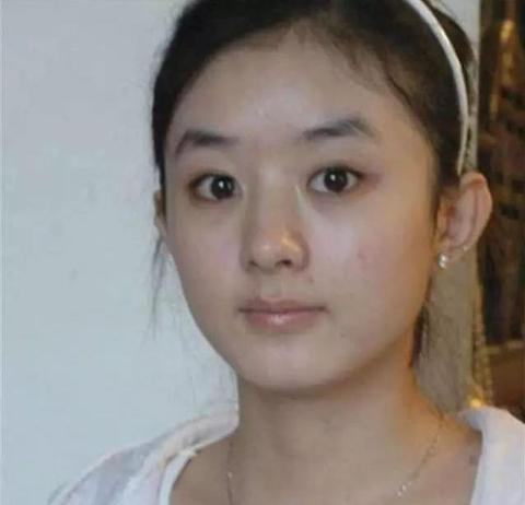 说脸娱乐圈扒皮系列——第三期,赵丽颖整容史赞同了文章2022-01-15 17