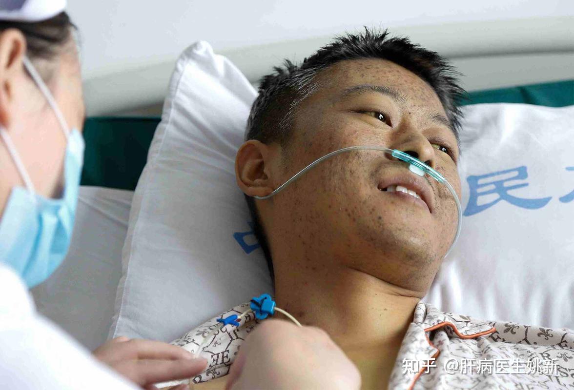 肝癌晚期怎么治 - 知乎