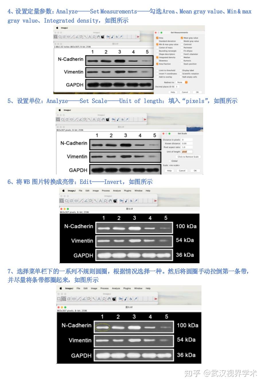 Image J 中WB条带灰度分析的详细步骤与便捷操作 - 知乎