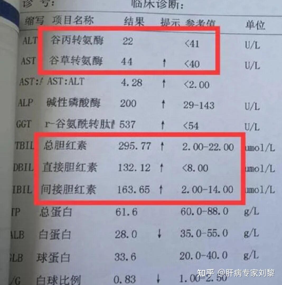 做完肝功能检查之后,如果提示胆红素升高,可能和下面这三个原因有关第
