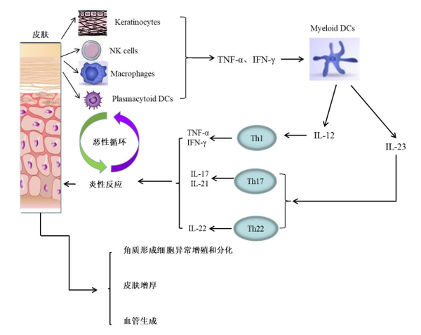 新一代银屑病药物：靶向以IL-17为代表的炎性细胞因子通路- 知乎