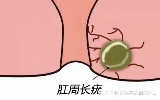 应该先想想自己有无不洁性接触史