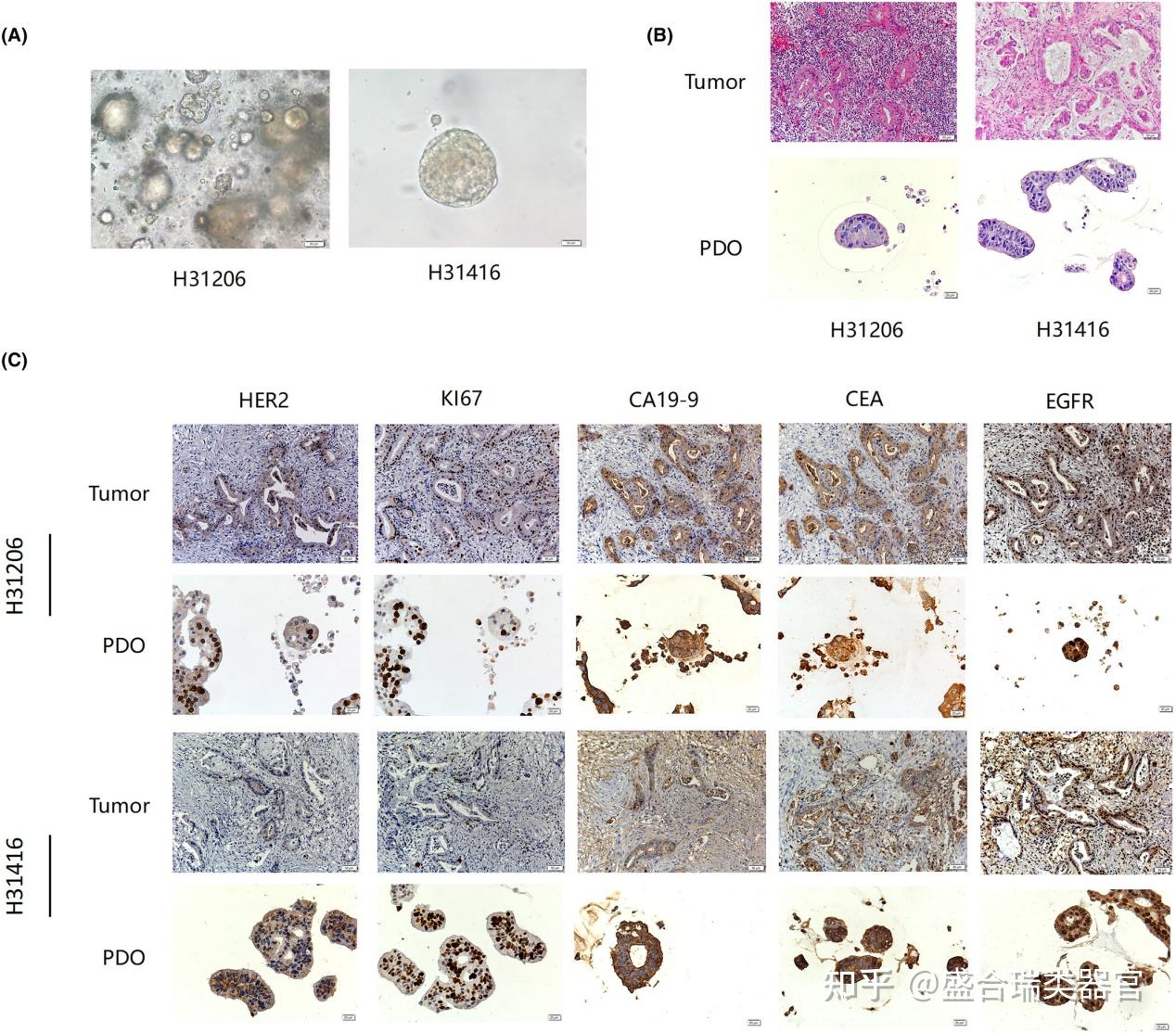 一文详解胰腺导管腺癌类器官模型的建立及个体化治疗策略的筛选