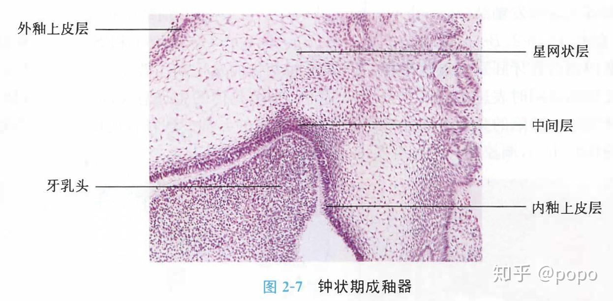 成牙本质细胞突图片
