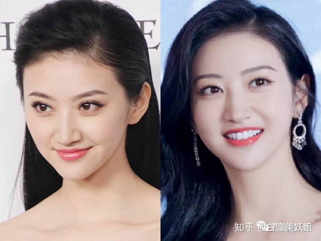 五官好看一笑就崩原来卧蚕厚高颧骨不同面部bug笑容方式大不同