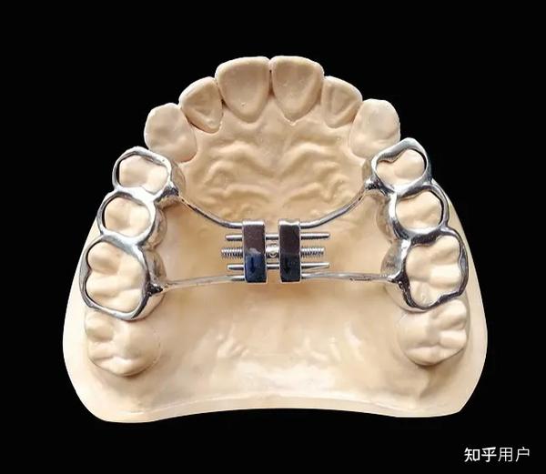 关于“扩弓器”你想知道的一切 - 知乎
