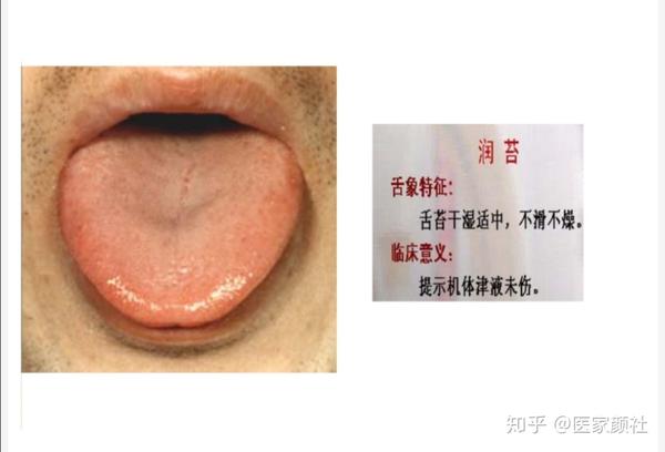 如何通过舌苔来判断身体健康与否?最全舌像来了,一分钟教你学会所有舌像! - 知乎
