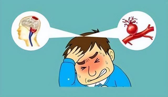 健康科普 | 突发的血管破裂,你了解吗 - 知乎