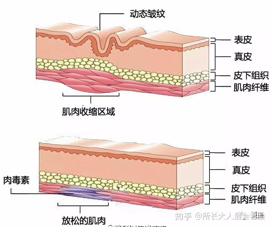 睡眠纹比法令纹、鱼尾纹可怕100倍,这些不良睡姿让60%的人变丑了! - 知乎