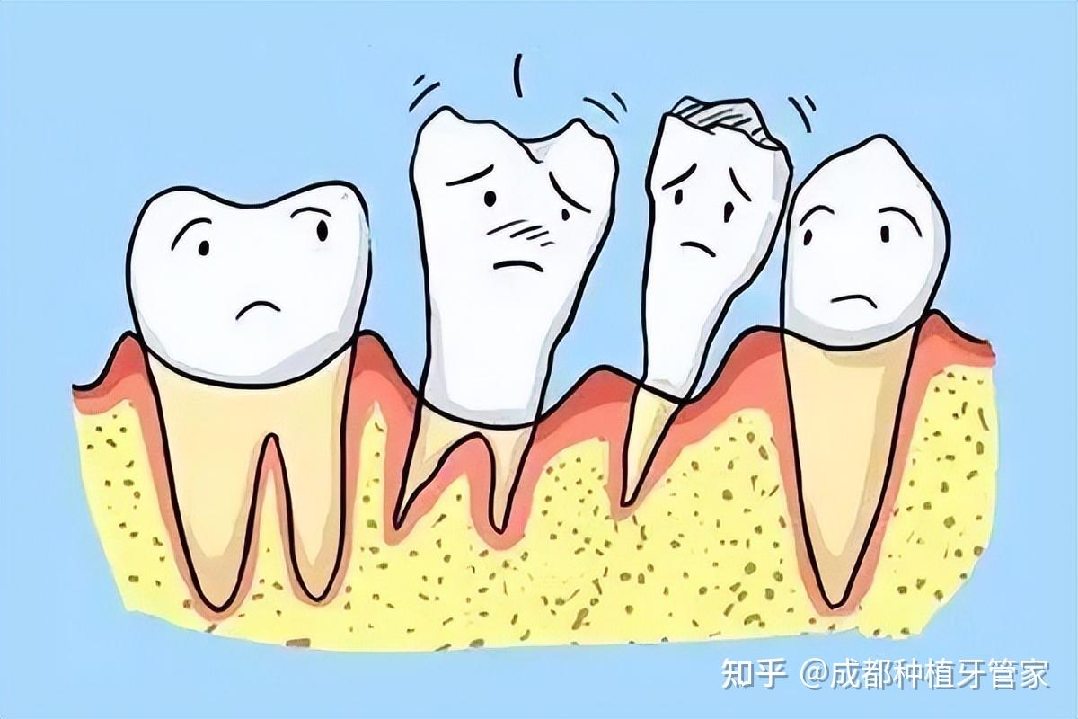 什么是牙周病?牙周病发生的原因是什么?-爱康健齿科