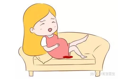 孕早期出血 常见原因 知乎