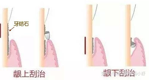 v2-acb7ddd56c3a849a831770588556f13b_r.jpg