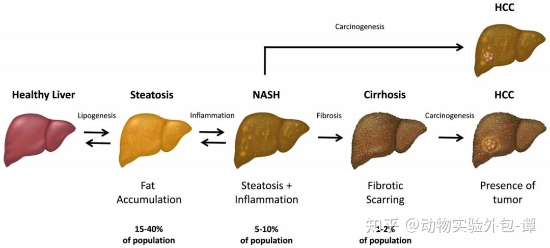 非酒精性脂肪性肝炎（NASH）动物模型构建 - 知乎