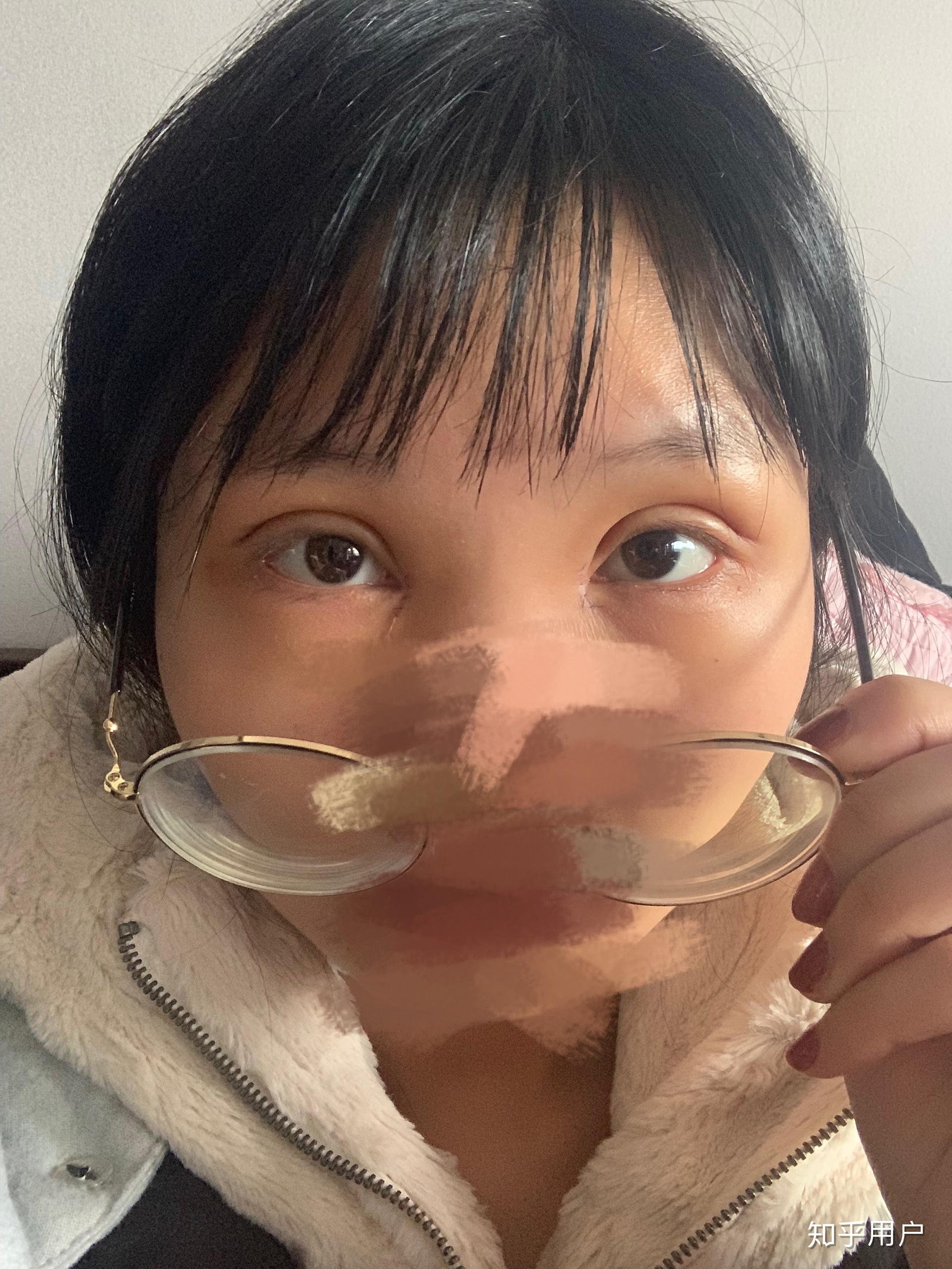 割双眼皮是种怎样的体验?