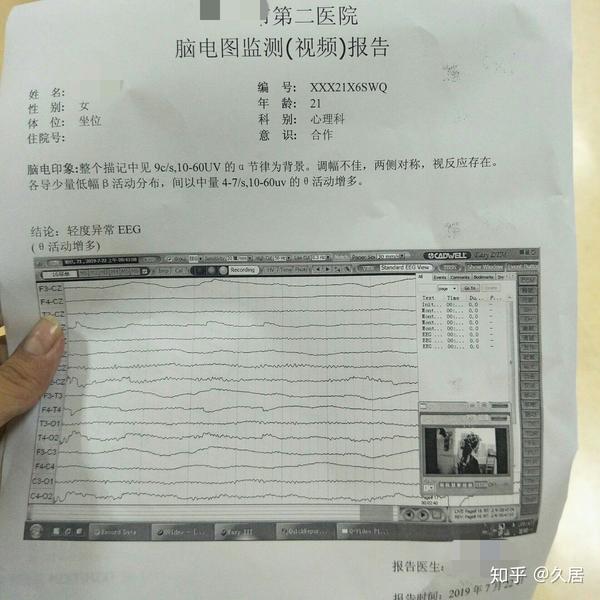 抑郁症检查 - 知乎