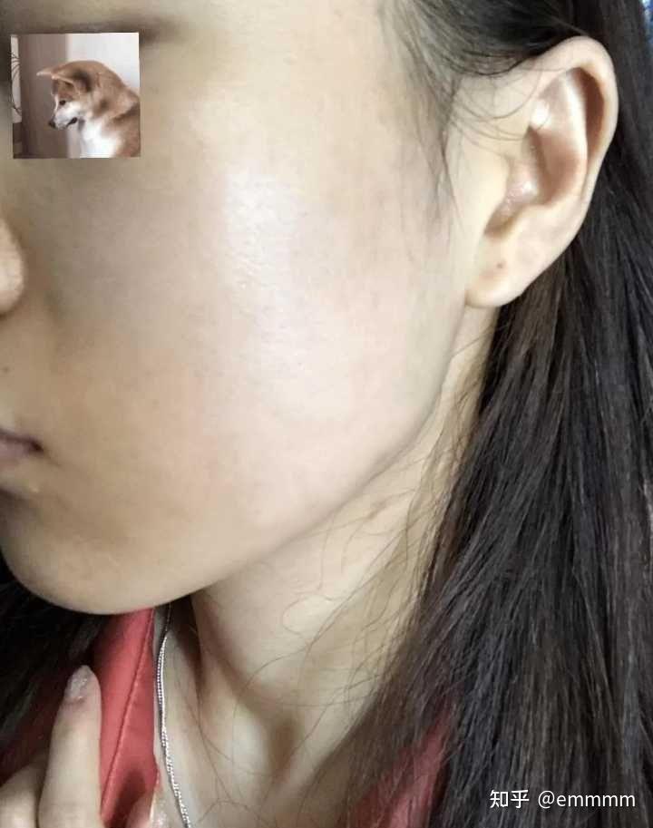 怎样可以美白啊 v2-ad349a5acd2e2453dca46a3b1aedf0c7_r.jpg