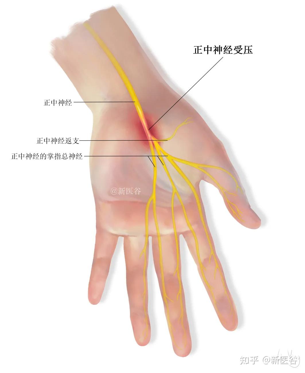 腕关节掌屈位示意图图片