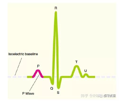 心电图知识学习干货满满送给需要的人