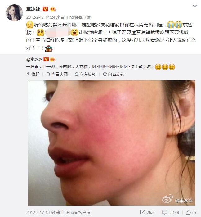 你身边有酒精过敏的人吗林志玲酒精过敏差点毁容