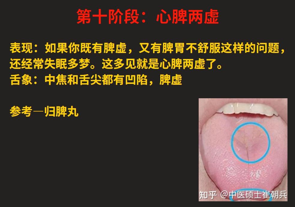 脾气虚、脾阳虚,由轻到重,看看自己的脾虚在哪个阶段?12个阶段的脾虚一次讲明白 - 知乎