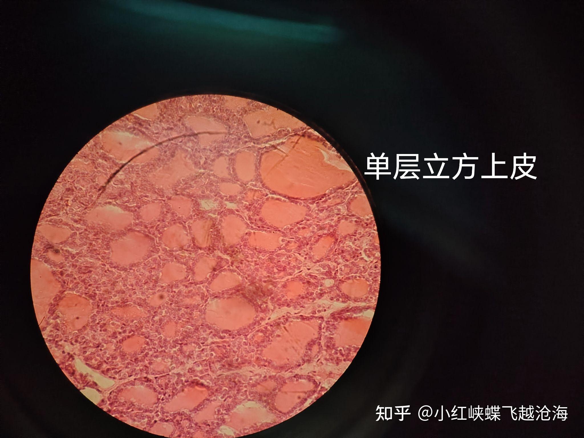 上皮组织细胞·显微镜观察图片/大学/组织胚胎/ - 知乎