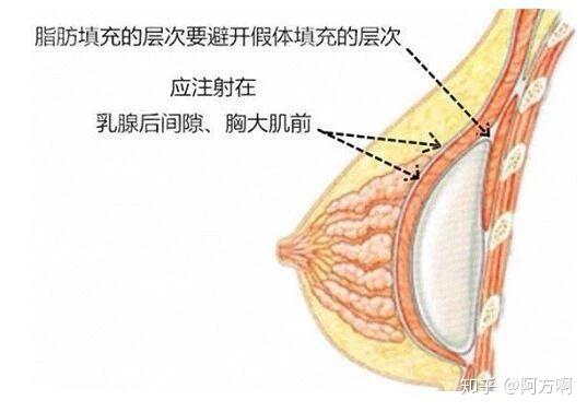 v2-ae5784b870e1c170ed22cbc69311e0e7_r.jpg