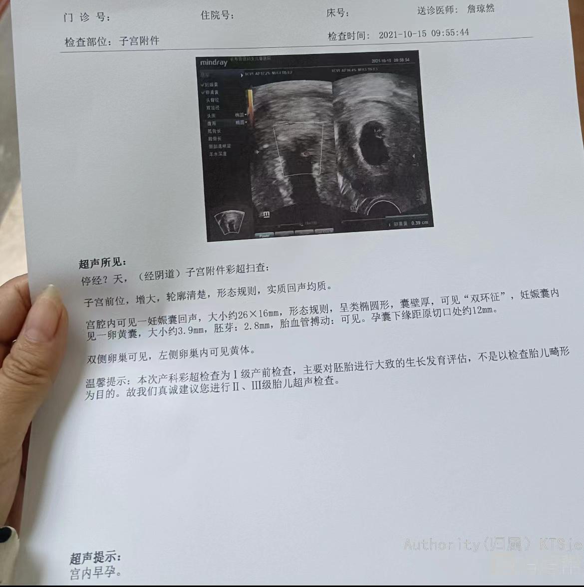 无痛人流和药流区别恢复的还行