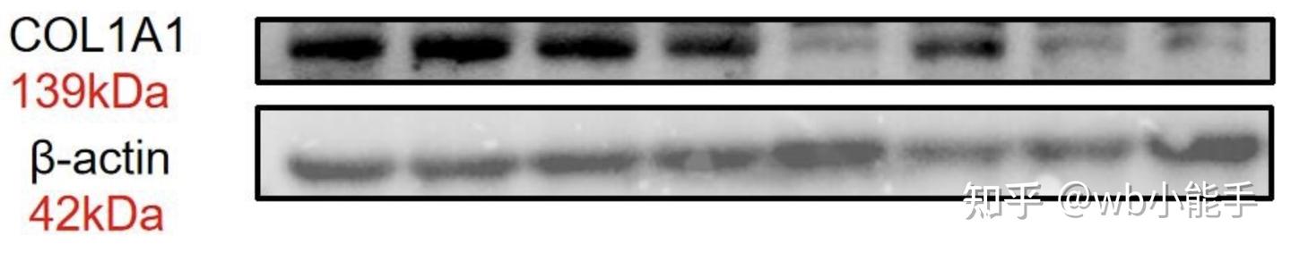 Collagen I alpha 1 (COL1A1) WB实验关键问题与解决方案 - 知乎
