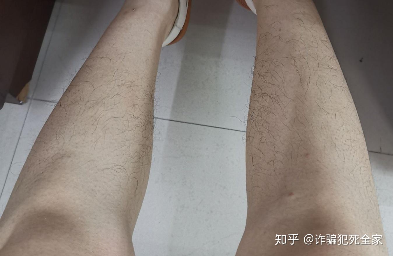 但是啊,腿毛啊,真是旺盛的要不得想看什么生活故事,想听什么真实案件