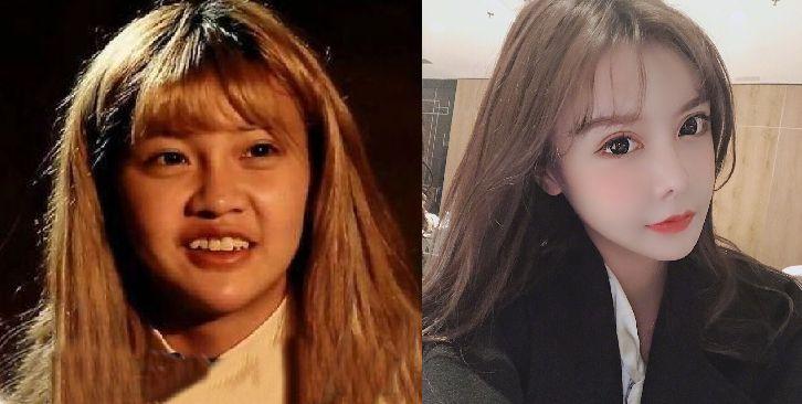 「已注销」 这期曲奇来给你们分享一下90整容带来的效益和弊端 : 本