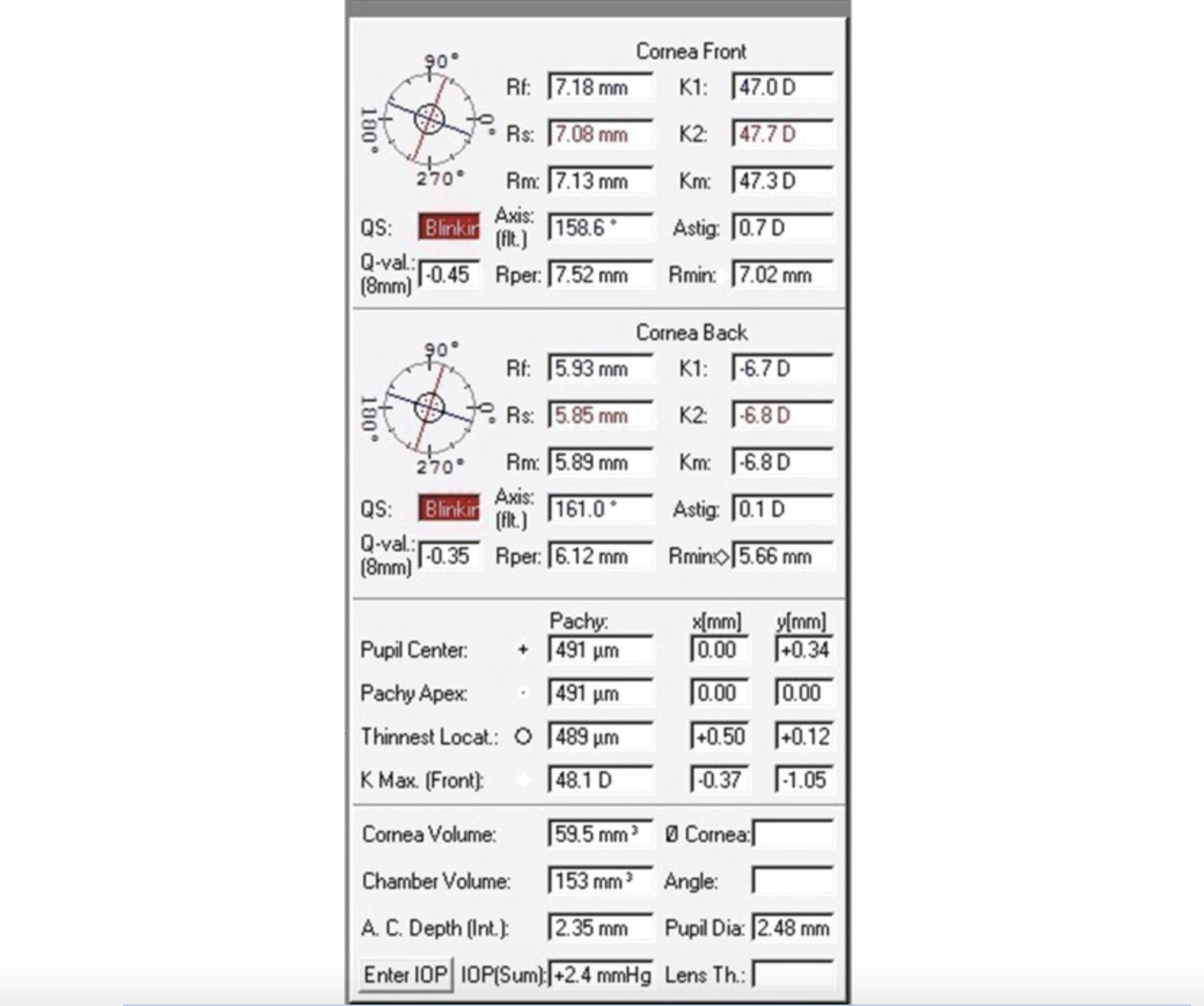 为什么超声角膜测厚检查怎么看角膜地形图呢？？_https://www.jmylbn.com_新闻资讯_第7张
