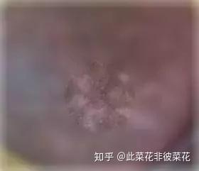 v2-af0438afee1225669d4fe53fb8d072eb_b.jpg