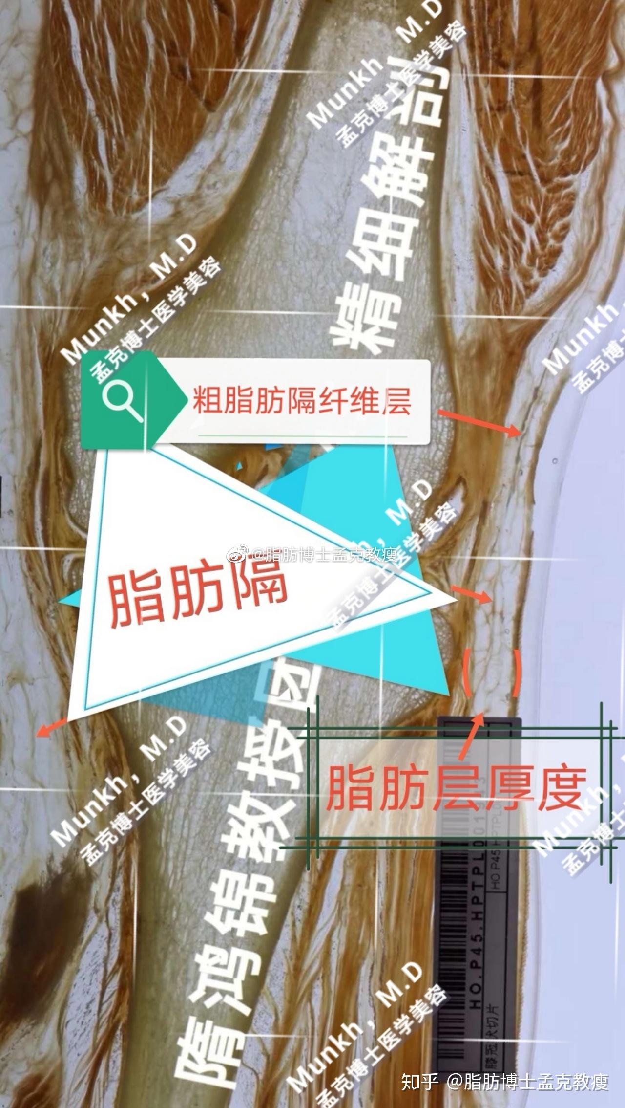 人体脂肪层脂肪层筋膜见过吗