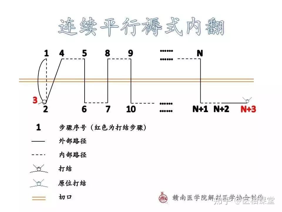 圖解常用外科縫合路徑