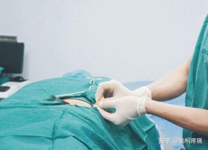 疼痛克星“小针刀”—— 小小针刀,大有疗效! - 知乎