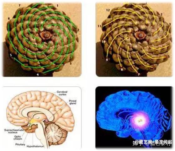 松果体连于图片