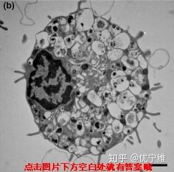 v2-af82fe90f85398e0b41713b081ae23c3_b.jpg
