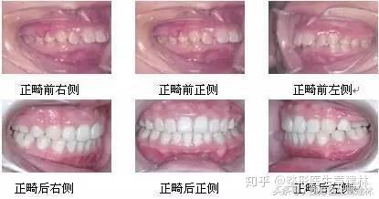 v2-af8e7fa1b3c6945a1612e4176c3dfddb_b.jpg